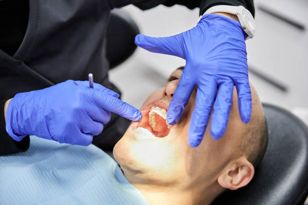 Best Emergency Treatment for Dental Infections or Abscesses in USA